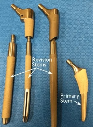 Revizyon Kalça Protezi Cerrahisi